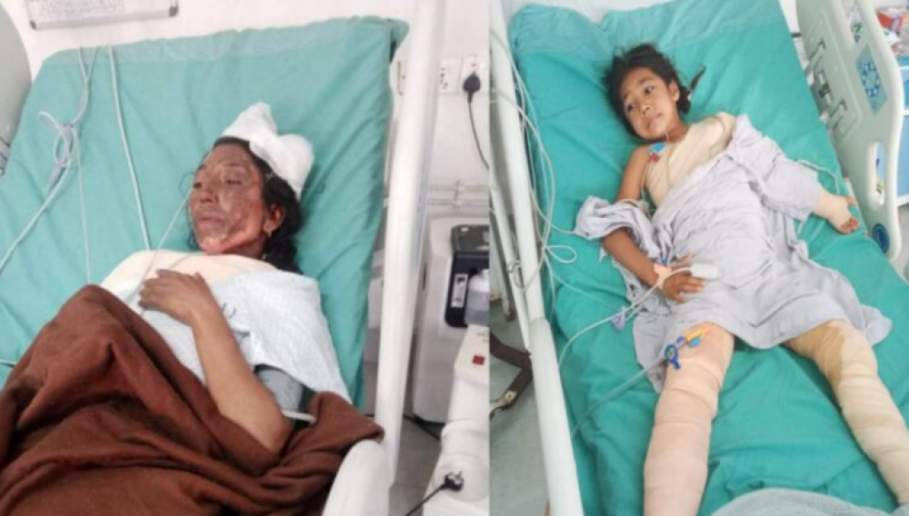 रामेछापमा चट्याङ लागेर आमा र छोरी घाइते